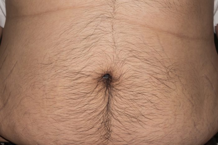 Belly Button Lint and Omphaloliths • BurntPorkChops