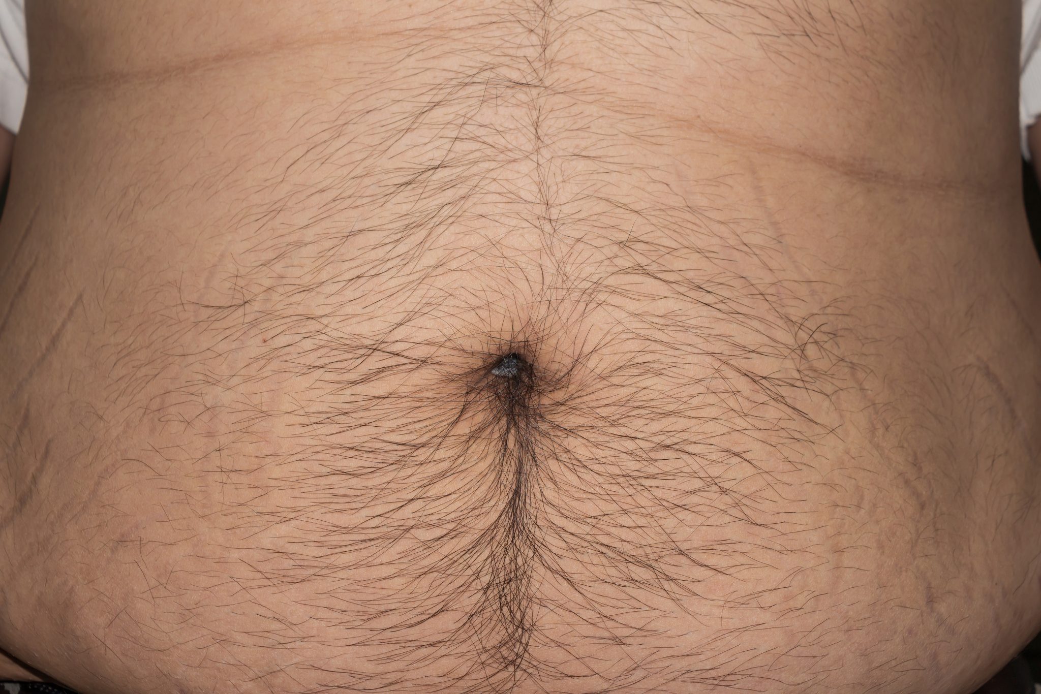Karl’s research says older men with hairy abdomens are often belly button l...